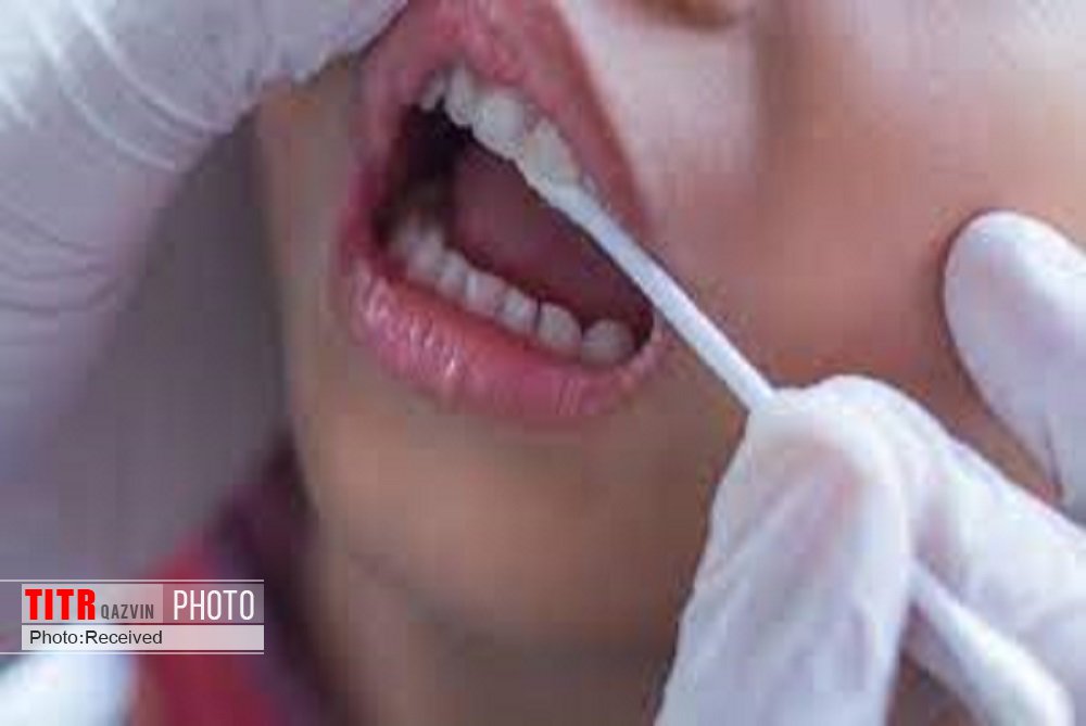 ارائه خدمات دندانپزشکی رایگان در مناطق مستعد قزوین